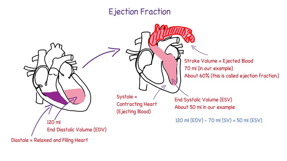 Introduction to Heart Failure