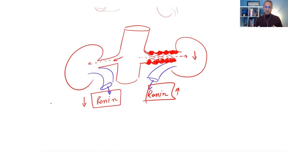 (Webinar) Hypertension Management (Part 3)