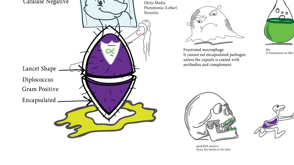 Streptococcus Pneumoniae (Pneumococcus) - Pathophysiology and Management