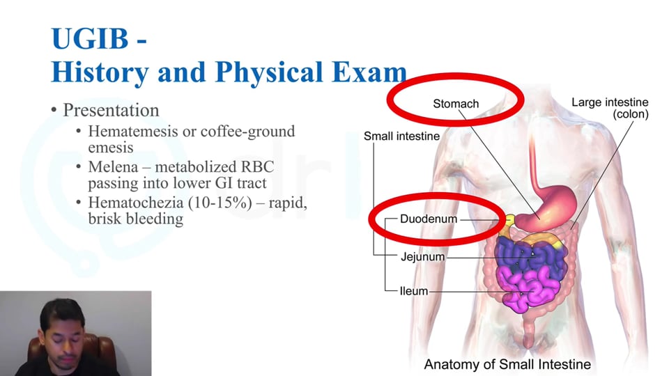 Gastrointestinal Bleeding