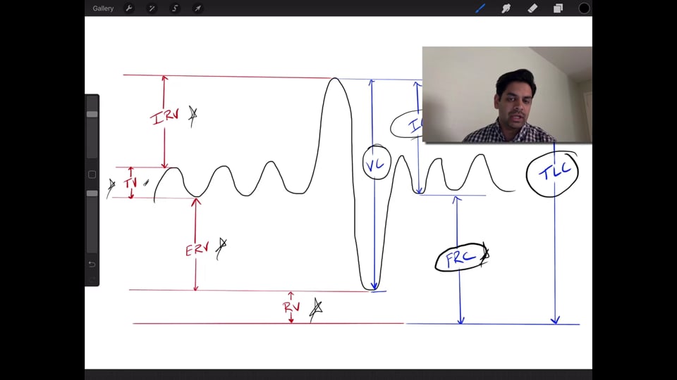 Interpretation of Pulmonary Function Tests