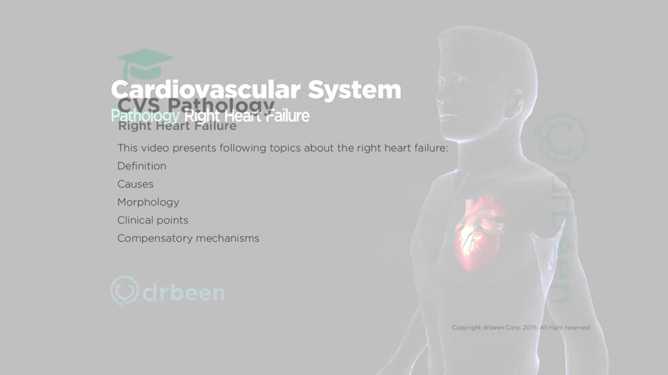 Right Sided Heart Failure