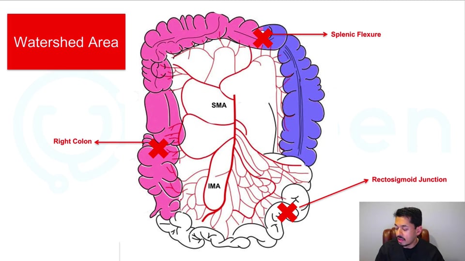 Ischemic Colitis: Clinical Diagnosis and Management