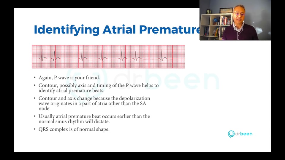 Atrial and Junctional Premature Beats