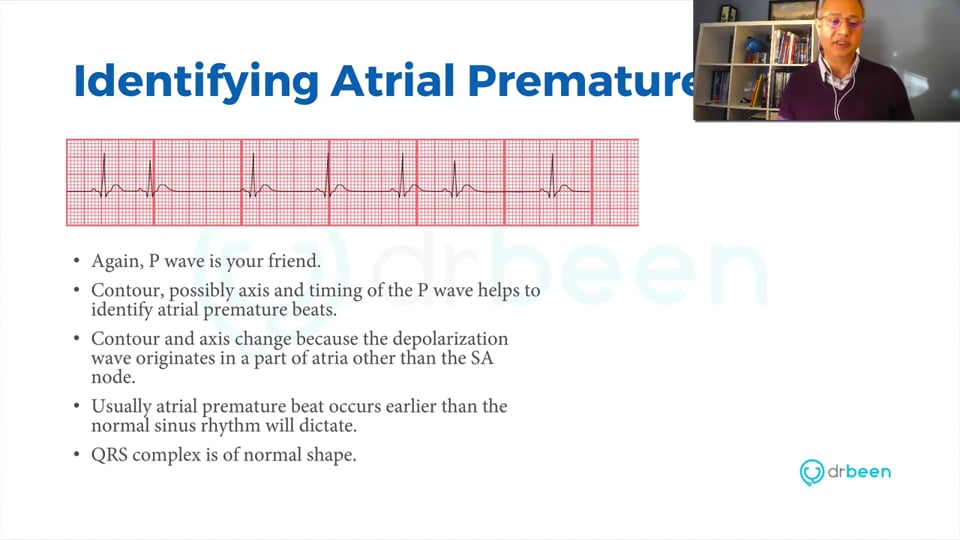 Atrial and Junctional Premature Beats