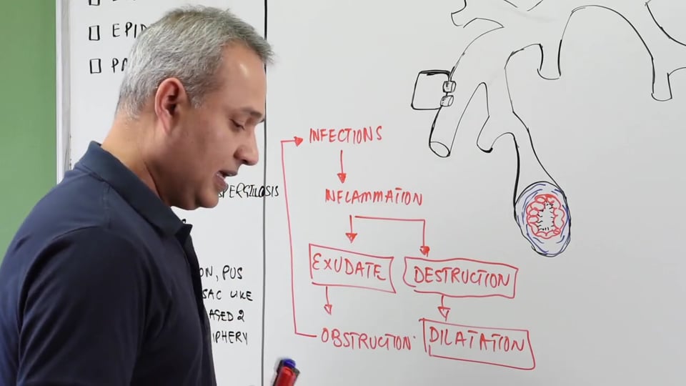 Bronchiectasis