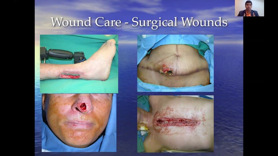 (Webinar) Wound Care and Management