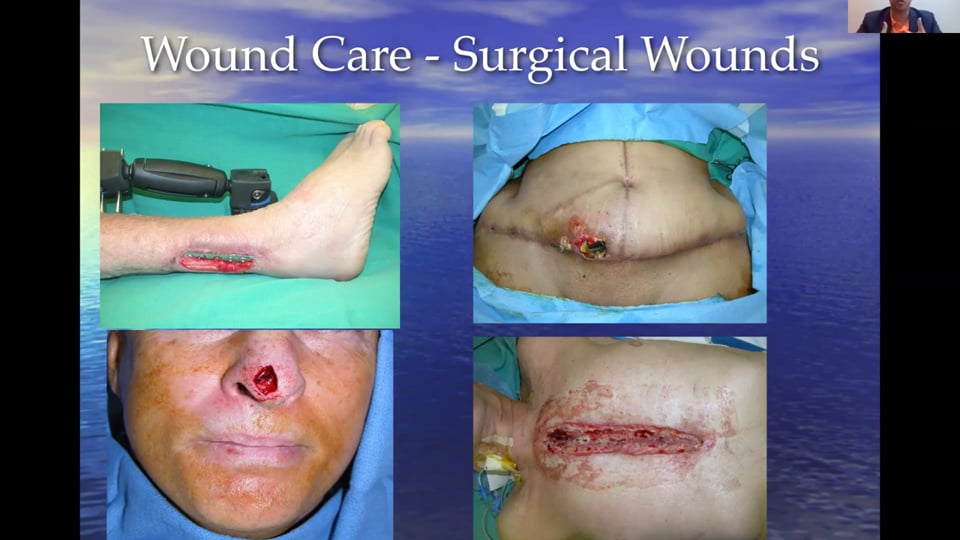 (Webinar) Wound Care and Management