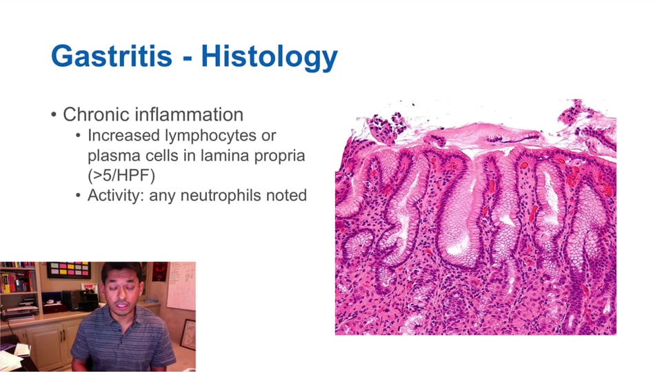 Gastritis