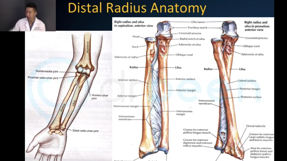 Distal Radial Fracture