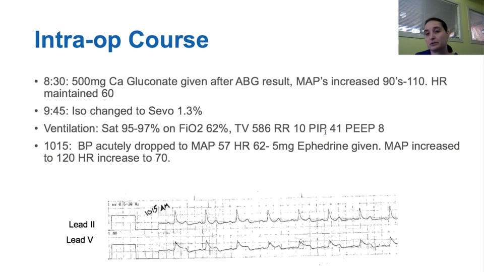 Acute ST Elevation MI during Non-Cardiac Surgery