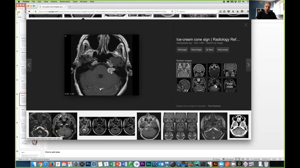 Cranial Nerve Discussion