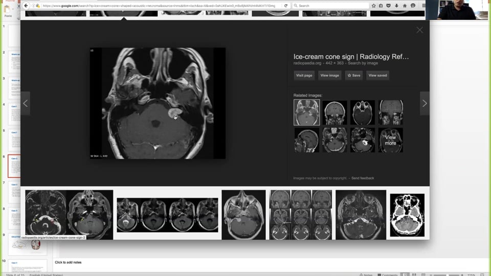 Cranial Nerve Discussion