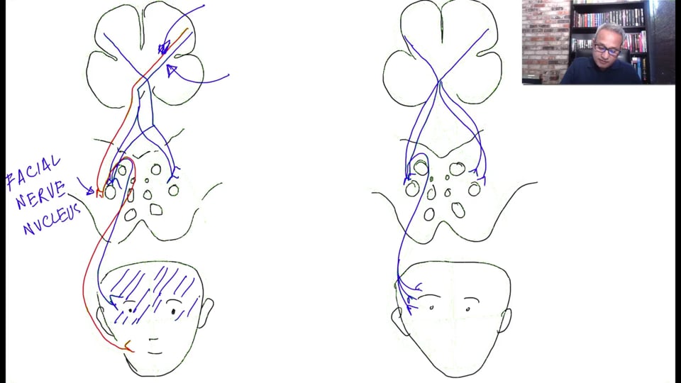 Bell's Palsy