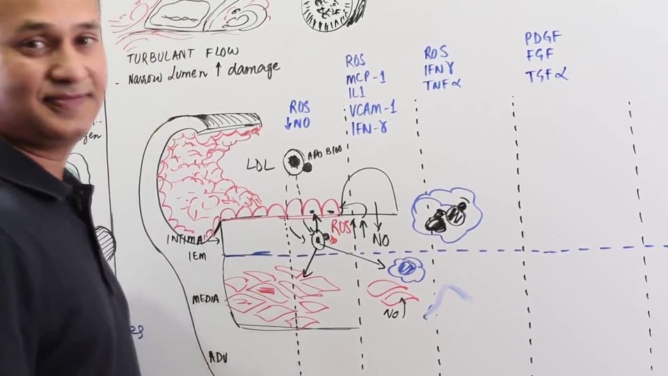 Atherosclerosis:Cellular Events (Part 2)