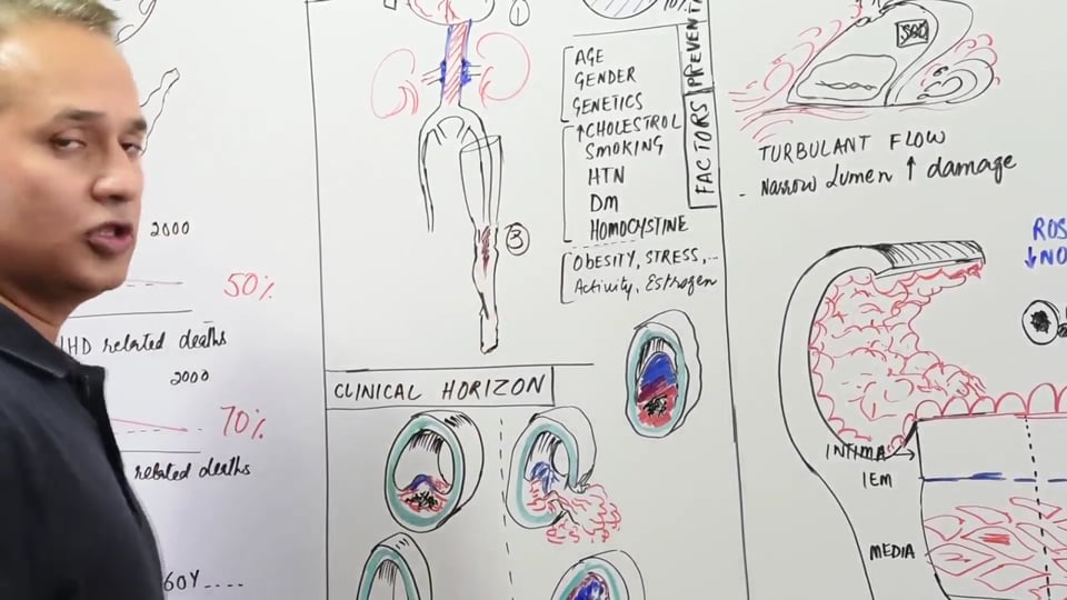 Atherosclerosis:Cellular Events (Part 1)