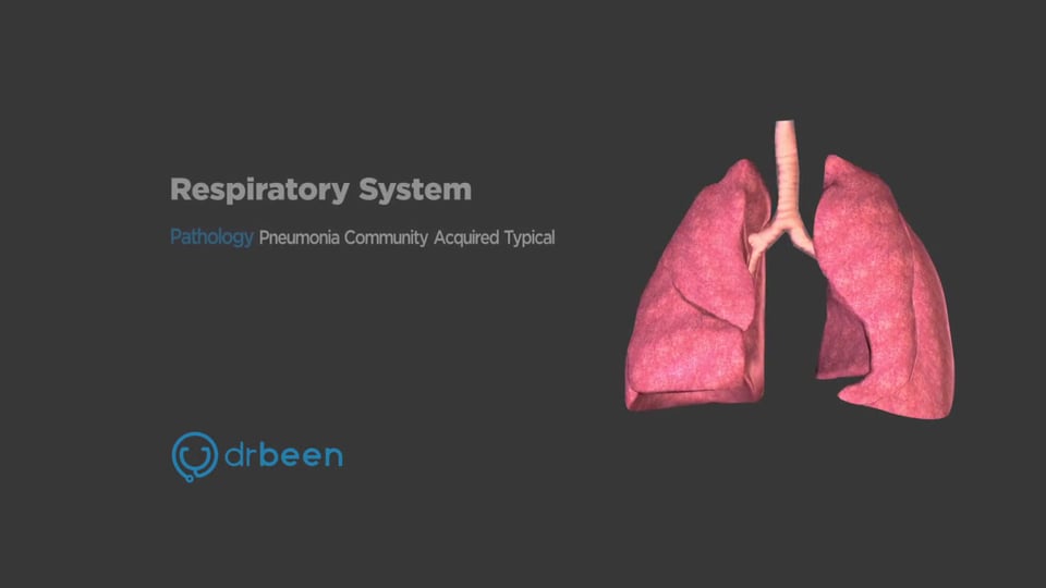 Community Acquired Pneumonia