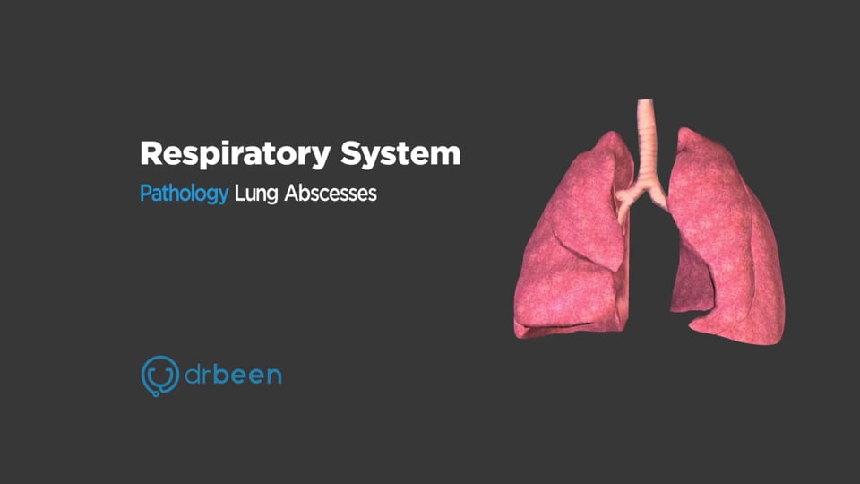 Lung Abscesses