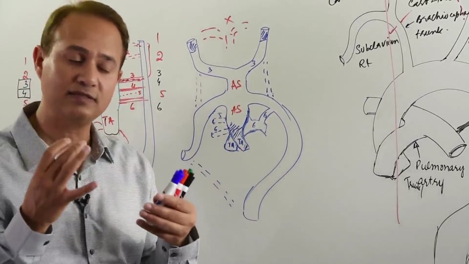 Pharyngeal Arch Arteries