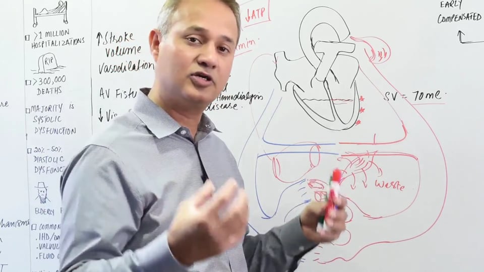 High Output Cardiac Failure: Diagnosis and Discussion