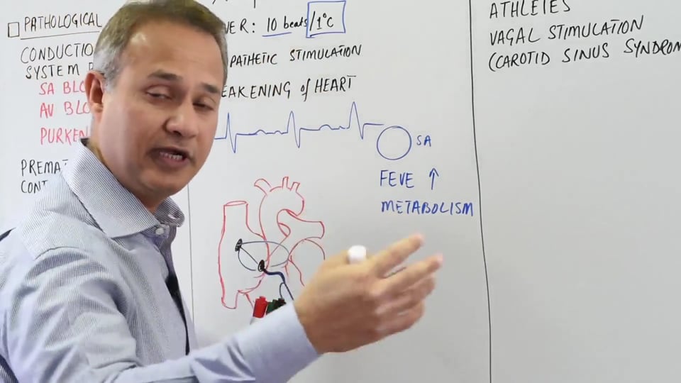 Abnormal Sinus Rhythm