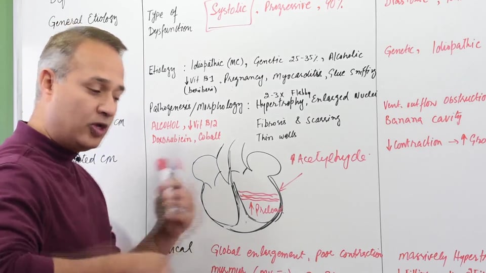 Cardiomyopathies