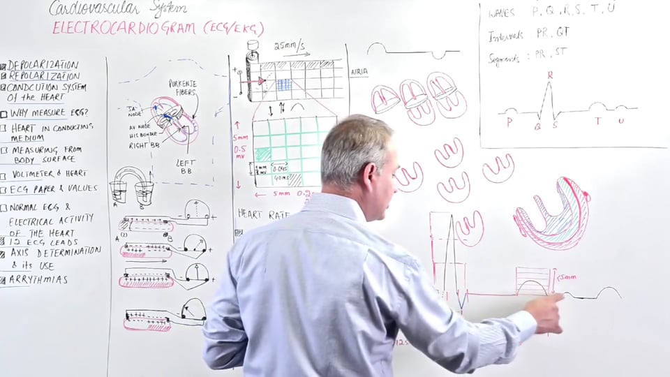 EKG Fundamentals: Measurement (Part 2)