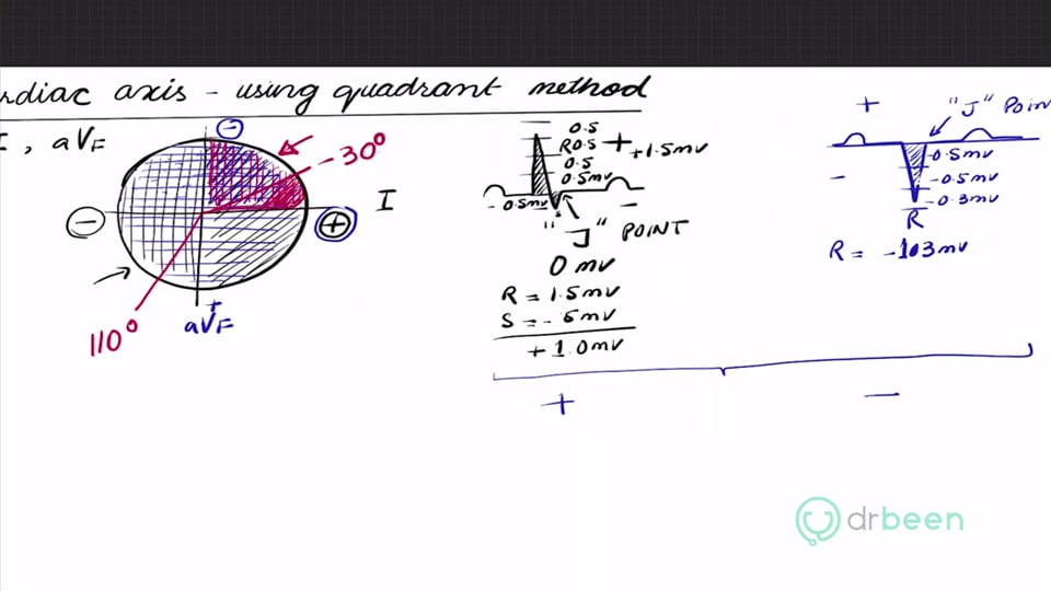 Cardiac Axis Using Quadrant Method