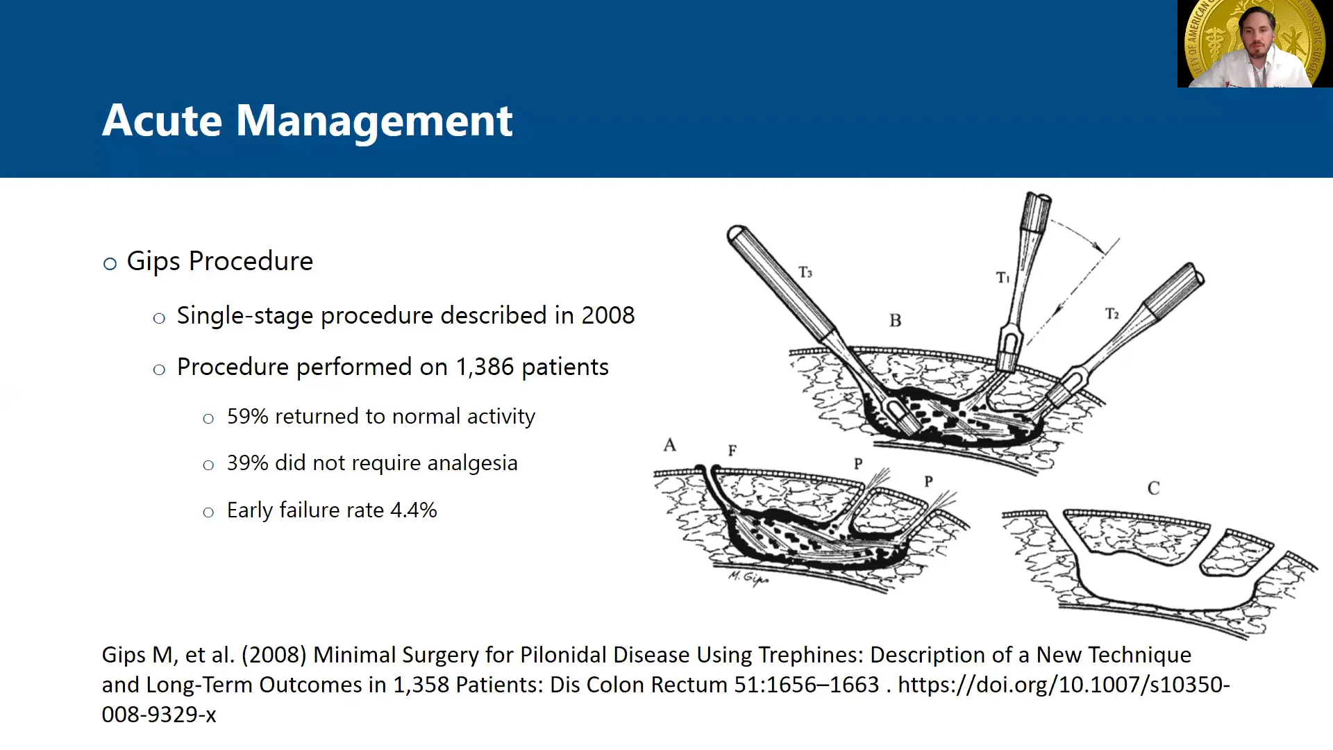 The Gips Procedure for Pilonidal Disease: A Retrospective Review of  Adolescent Patients