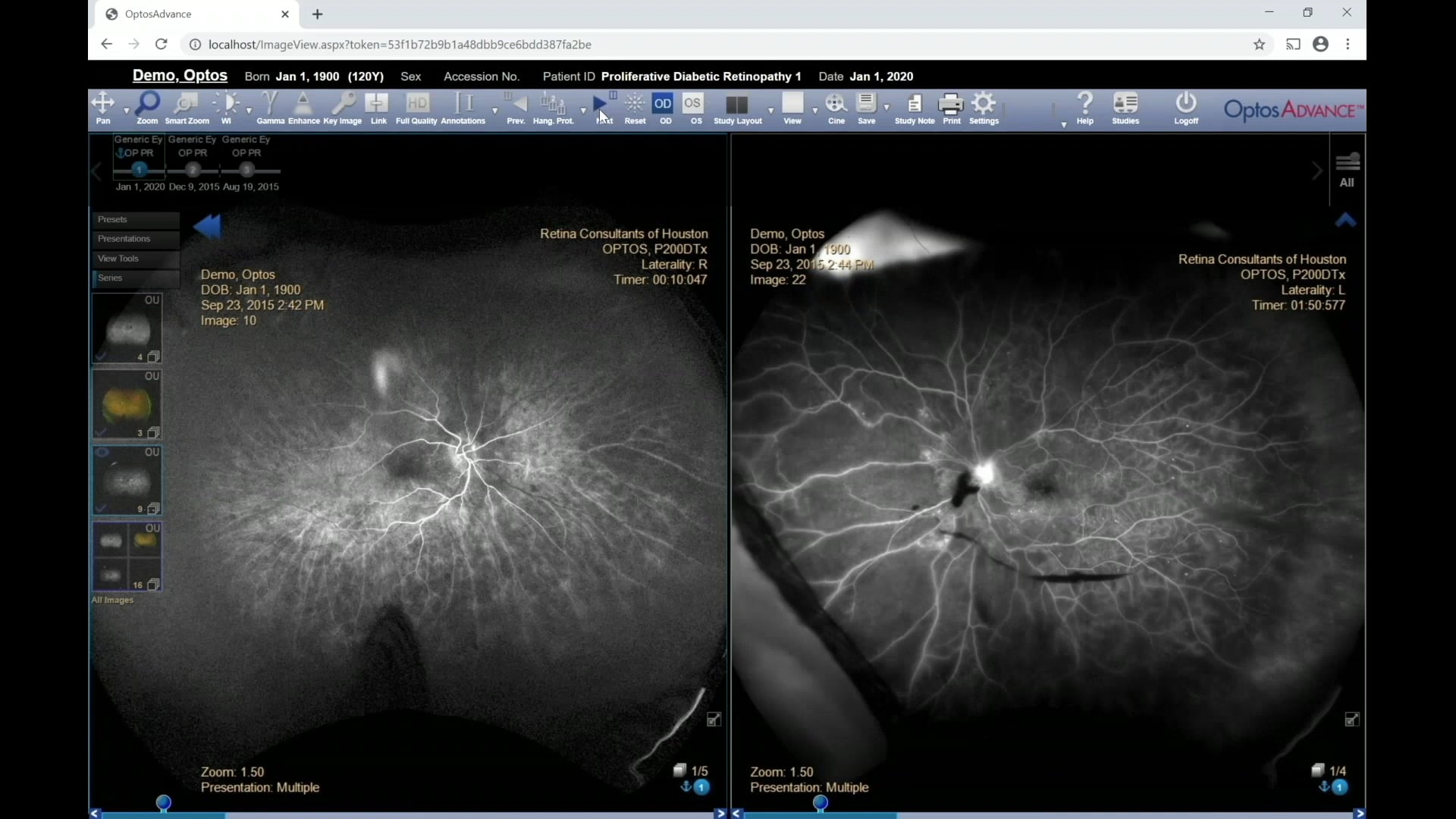 OptosAdvance Tutorial How to Review Images on Vimeo