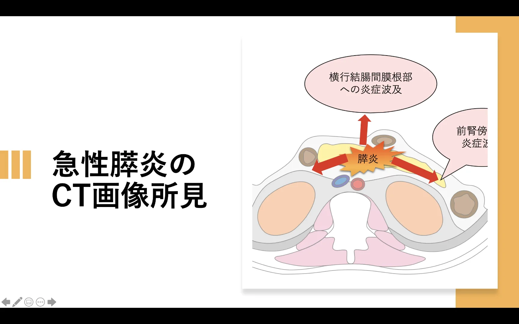 腹部画像解剖　徹頭徹尾 メジカルビュー社｜画像医学・放射線医学｜画像解剖 徹頭徹尾