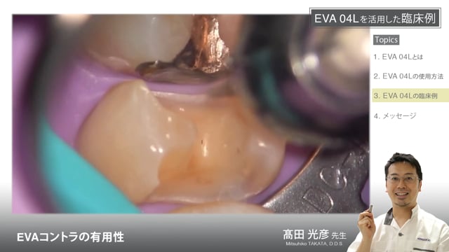 EVAコントラの有用性