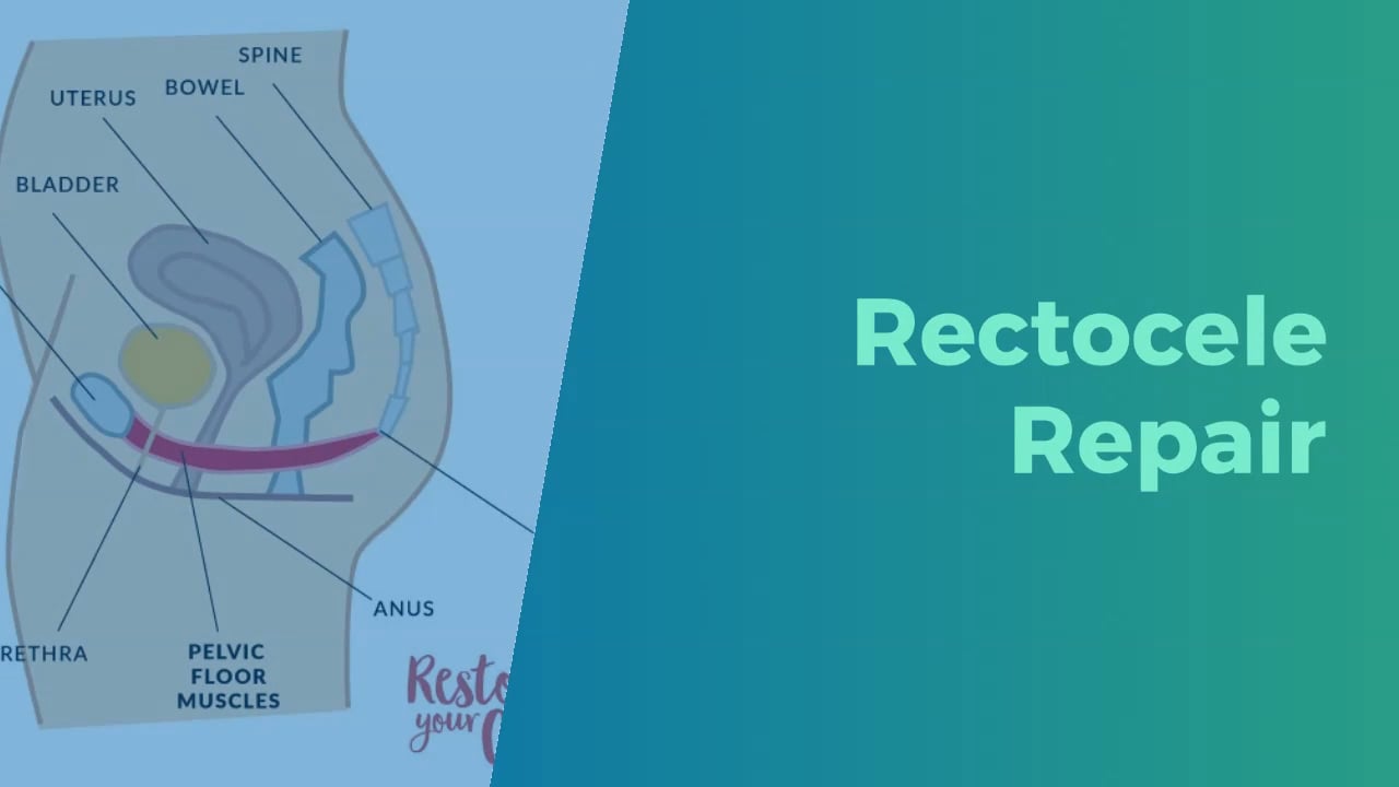 Rectocele Repair - Restore Your Core On Vimeo