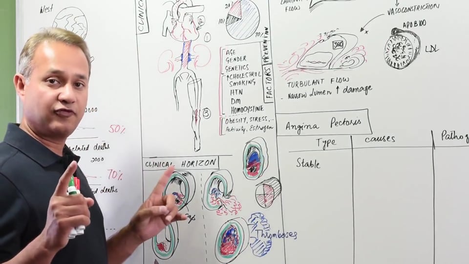 Angina Pectoris (Chest Pain)