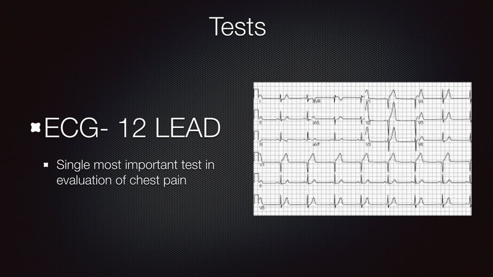 A Differential Diagnosis of Acute Chest Pain