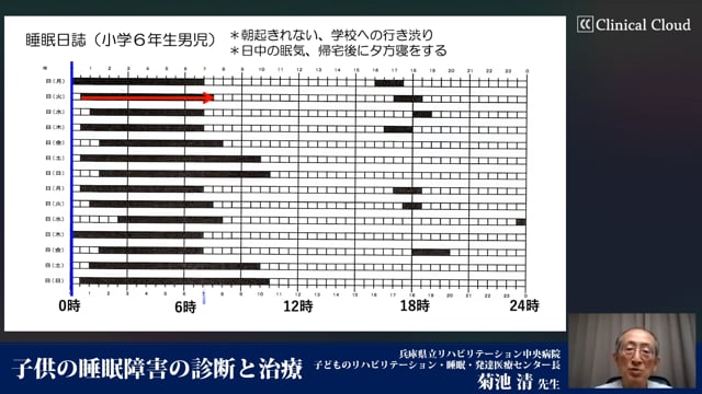 子どもの睡眠障害の診断と治療 -Part1-