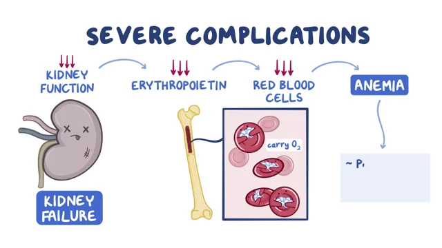 Kidney transplant recommending actions Meaning of the diagnostic codes