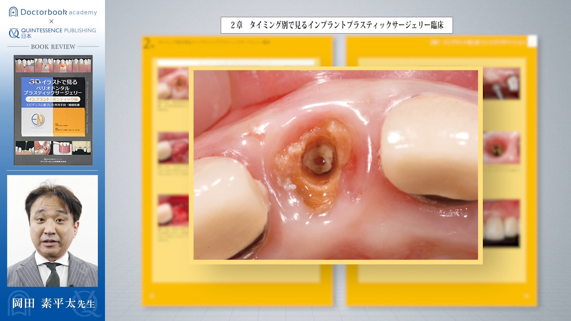 公式プロモーション 【裁断済】エビデンスに基づいた ペリオドンタル