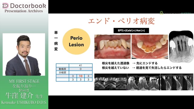 #2 エンド・ペリオ病変