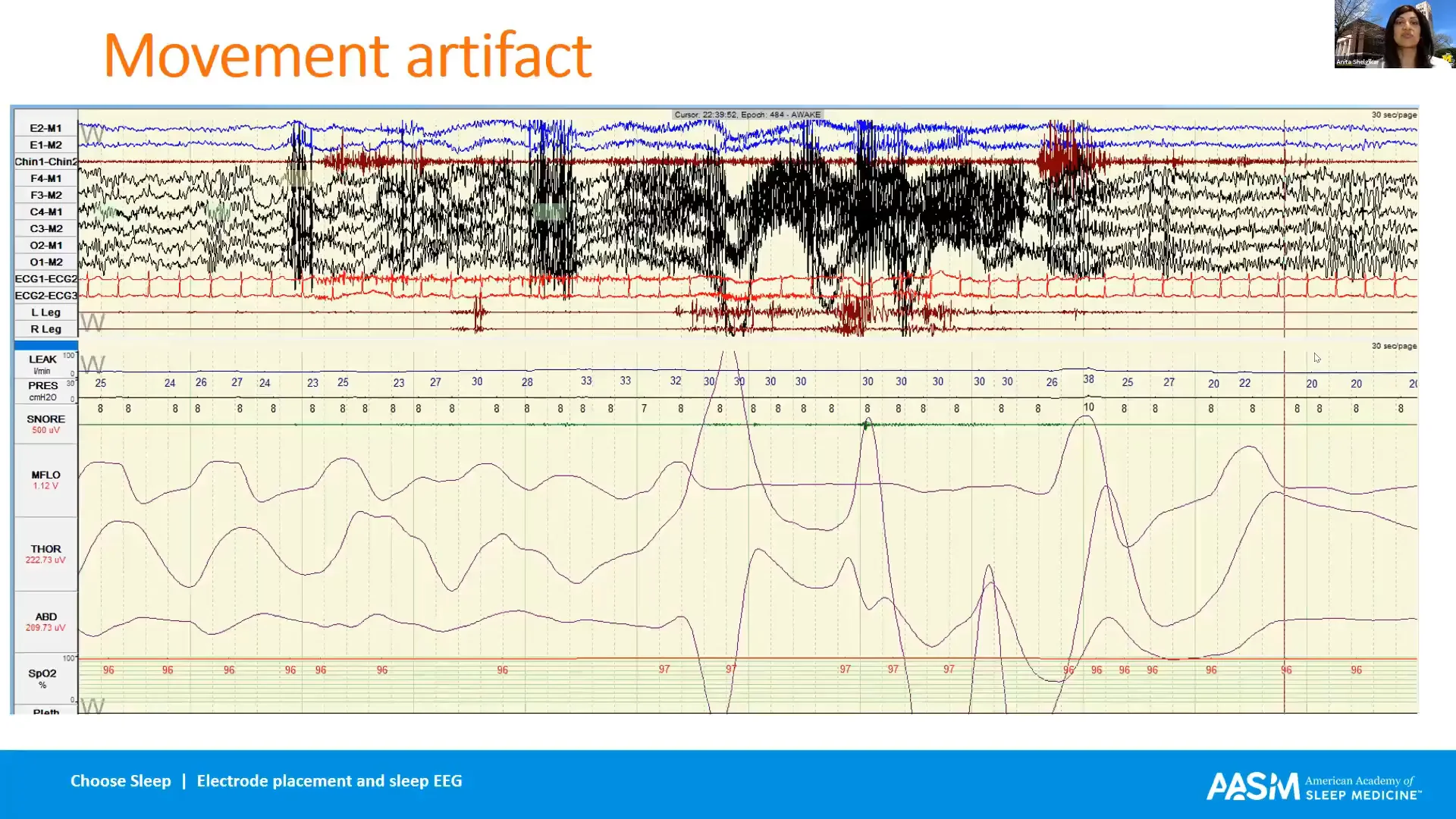 2020-aasm-virtual-boot-camp-electrode-placement-and-sleep-eeg-anita