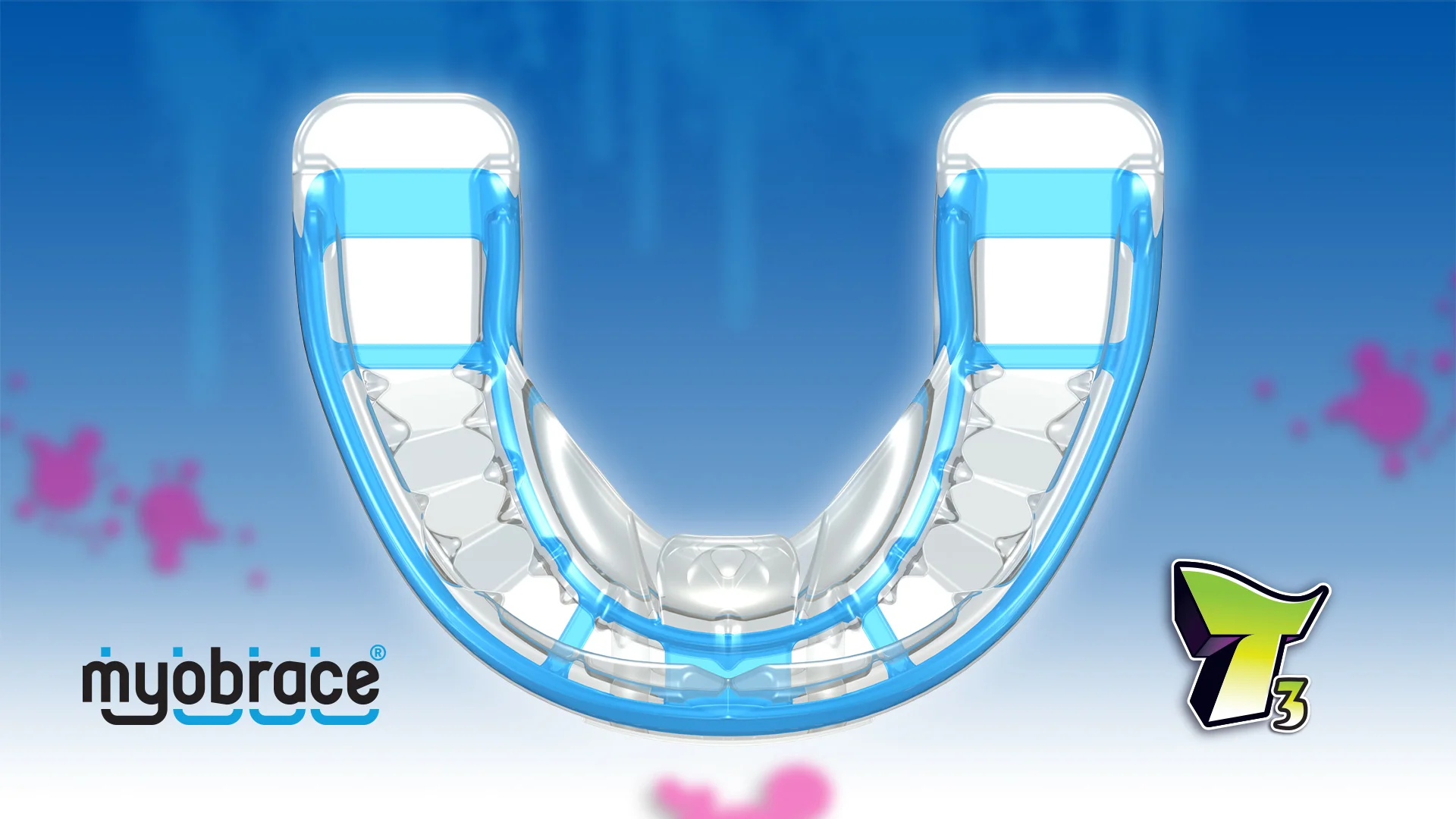 myobrace　Medium i-3