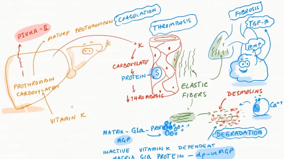 Vitamin K Deficiency and COVID-19