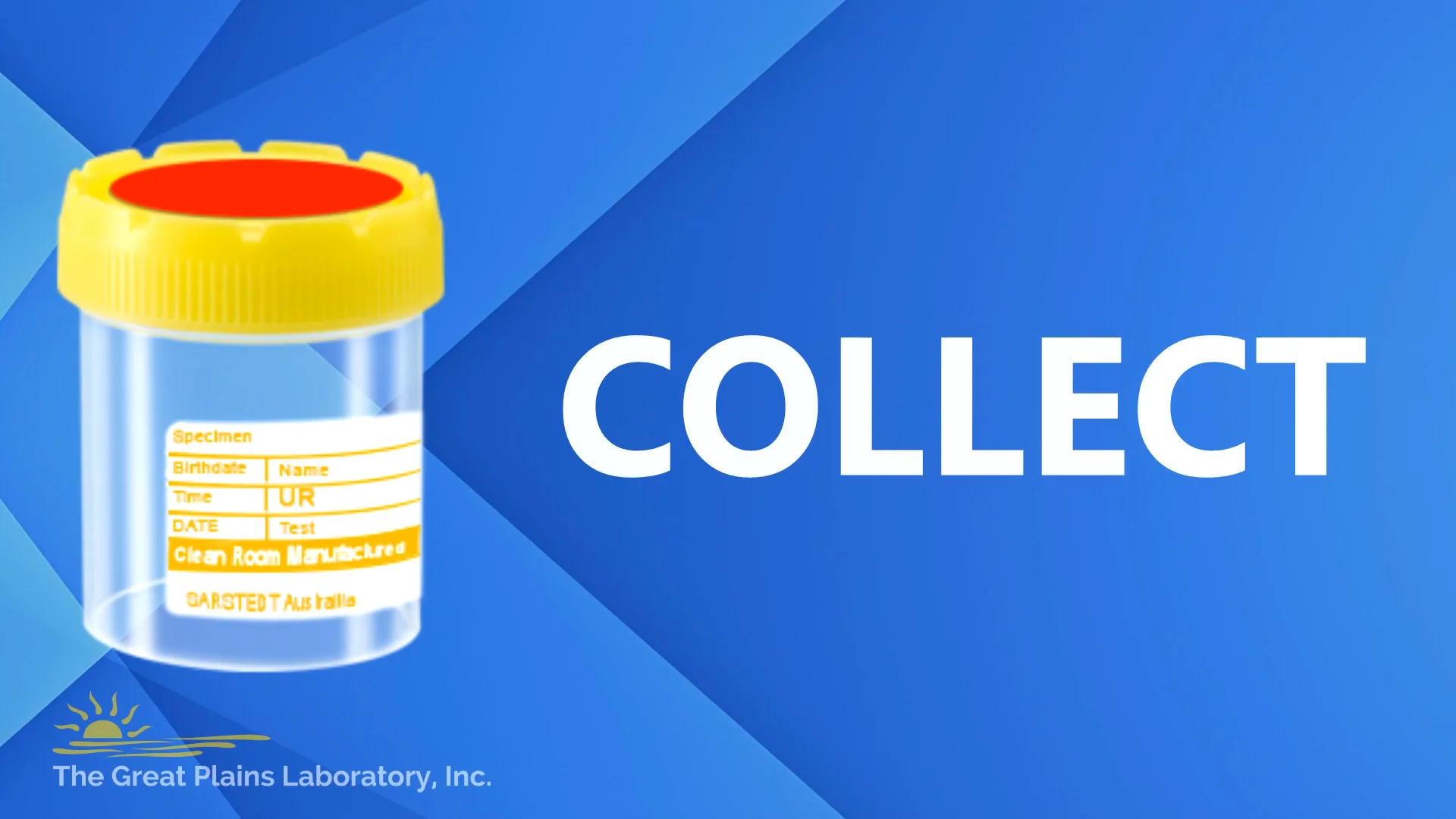 GPL Urine Collection Instructions