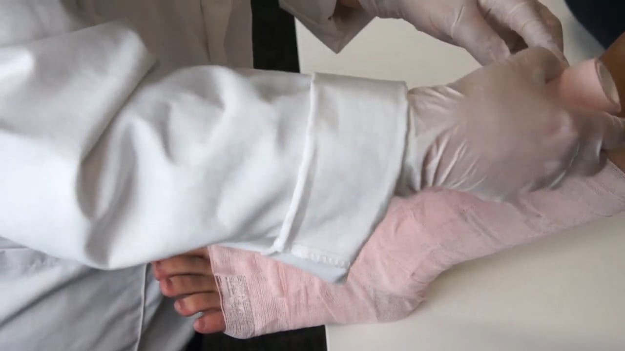 How To Apply an Unna Boot Paste Bandage on Vimeo