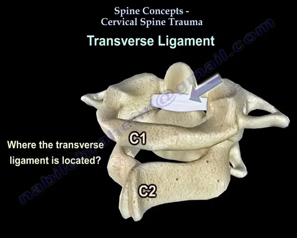 transverse ligament cervical spine