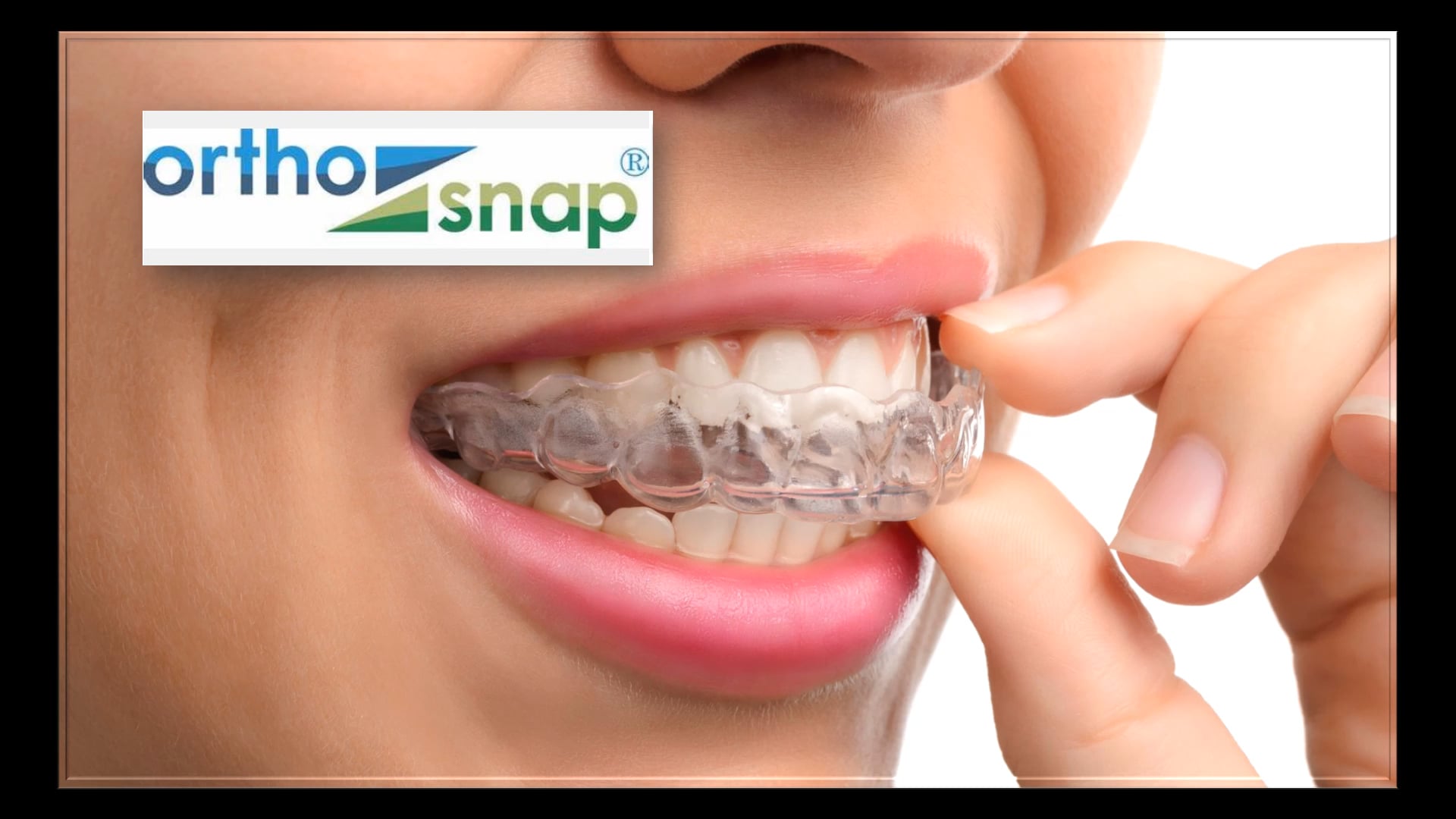 OrthoSnap on Vimeo