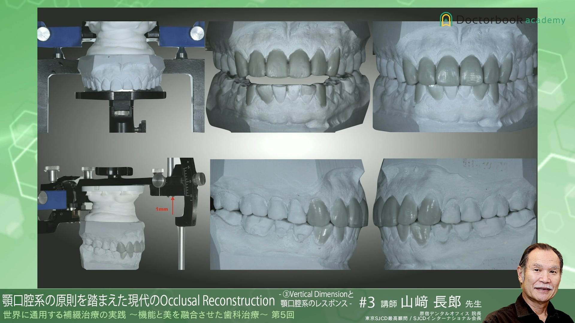 #9 Vertical Dimensionと顎口腔系のレスポンス