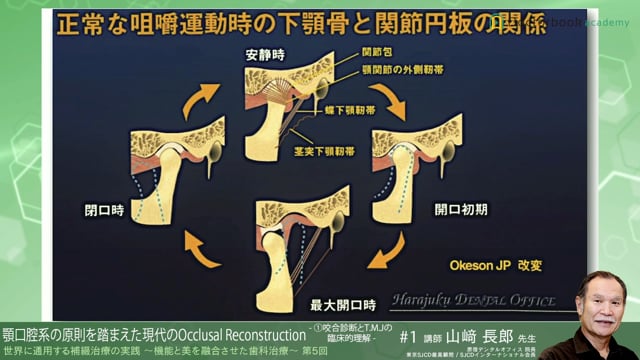 #1 咬合診断とT.M.Jの臨床的理解