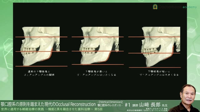 #7 Vertical Dimensionと顎口腔系のレスポンス