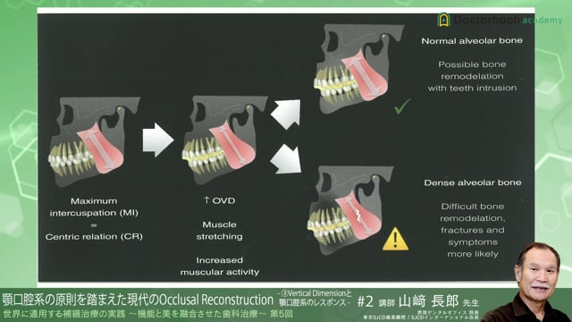 #8 Vertical Dimensionと顎口腔系のレスポンス【03/20-03/26 プレミアム化】